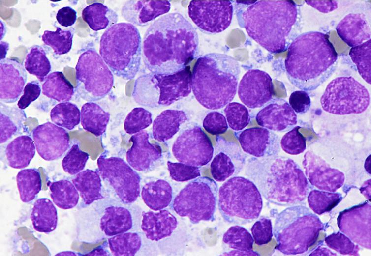 Cytodiagnostic investigation of a cat with generalized enlargement of the lymph nodes; lymphoma was suspected.