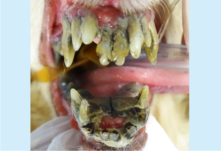 Figure 1: Severe periodontal disease