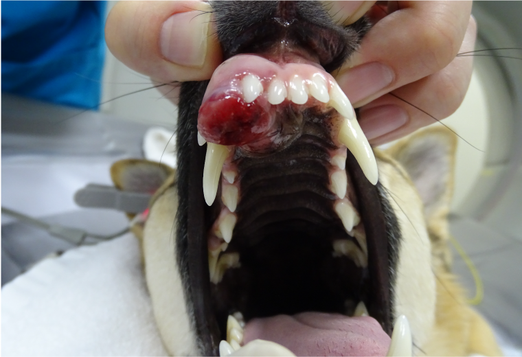 Figure 6: Tumor in the oral cavity