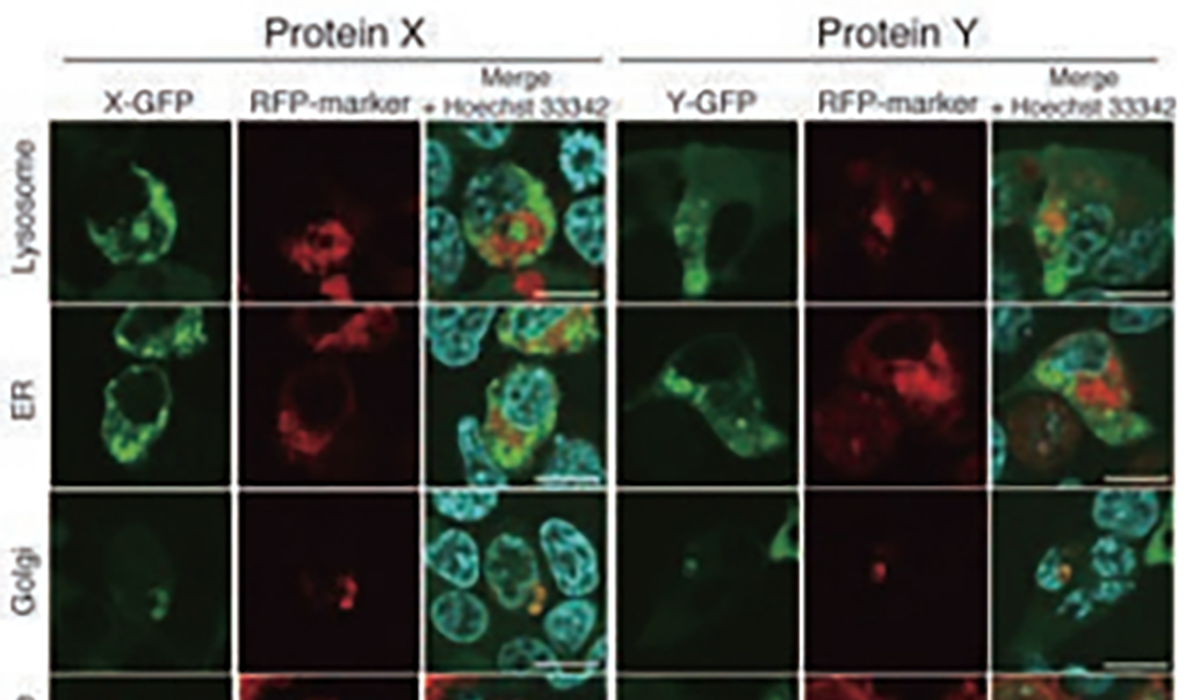 タンパク質の細胞内局在の解析