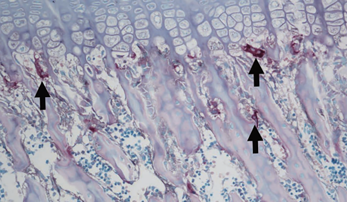 ラット大腿骨脱灰標本の ALP/TRAP 染色による破骨細胞と骨芽細胞の検出（矢印：破骨細胞）
