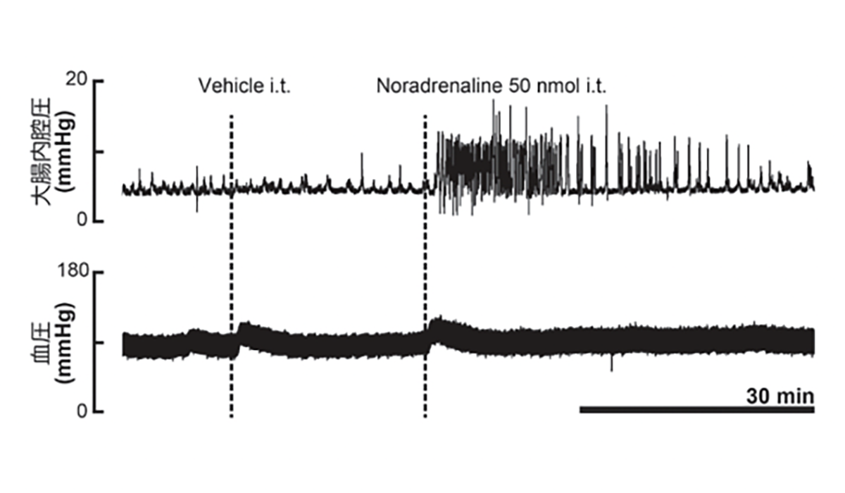 ノルアドレナリンの脊髄内投与による大腸内腔圧（上）と血圧（下）の変動