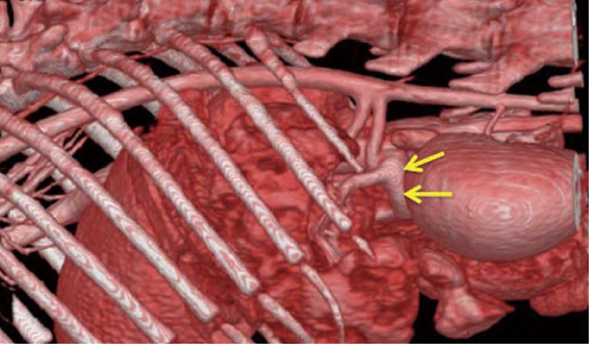 血管奇形の犬のCT像で3D表示