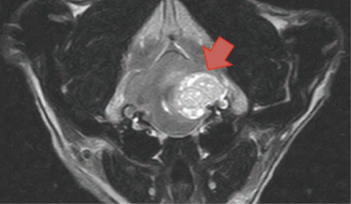 脳内にできた犬の腫瘍（矢印）のMRI 画像（Gd 造影T1 強調画像）